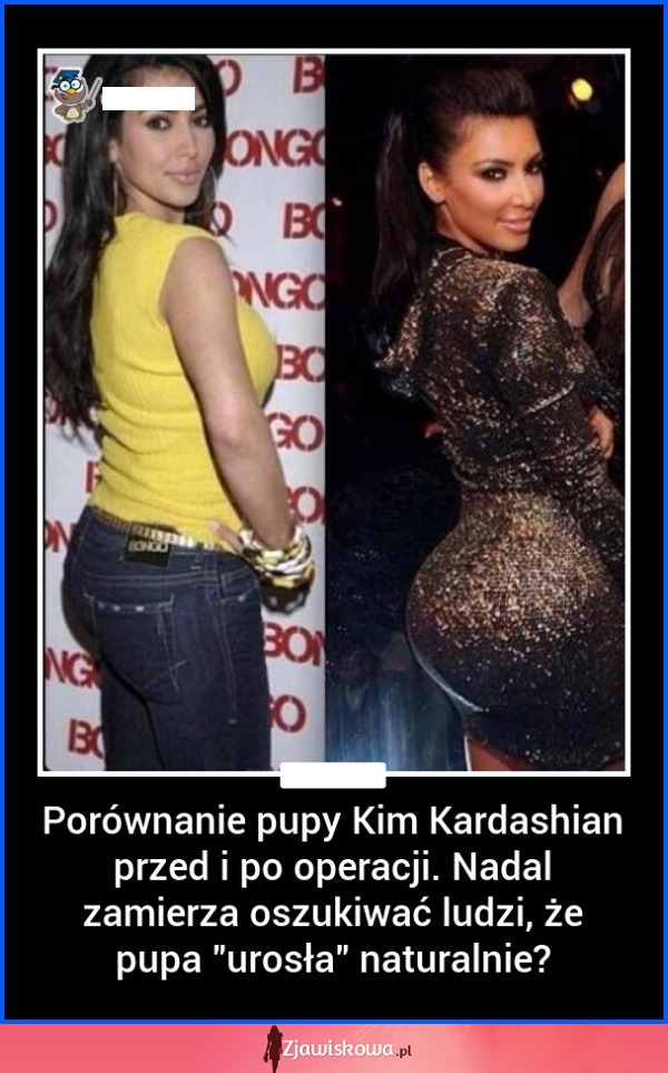 Tak wyglądała pupa Kim Kardashian przed opercjami plastycznymi! SZOK!