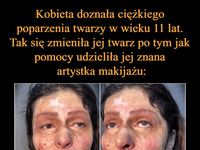 Kobieta dostała ciężkiego poparzenia twarzy w wieku 11 lat. Tak się zmieniła jej twarz, dzięki pomocy makijażystki